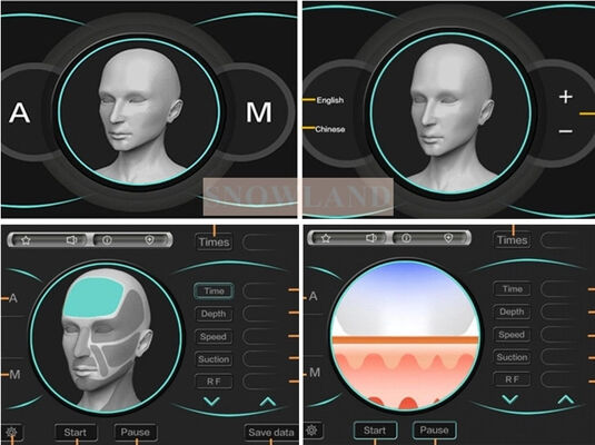 Macchina per la depilazione laser a diodo laser a semiconduttore da 808 nm con sensore a contatto con la pelle che garantisce un trattamento di depilazione rapido